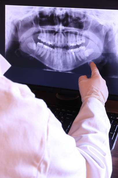 Best Emergency Root Canal Treatment in Viola, NY