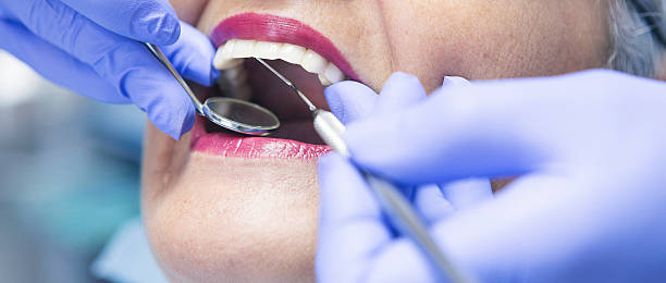 Best Emergency Dentist for Knocked-Out Tooth in Viola, NY